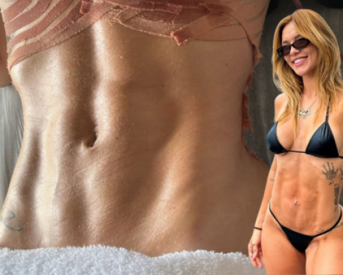 Virginia Fonseca exibe resultado de cirurgia após três gestações, veja agora!