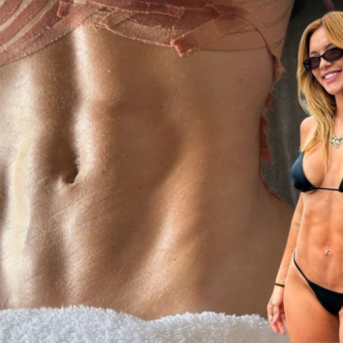 Virginia Fonseca exibe resultado de cirurgia após três gestações, veja agora!
