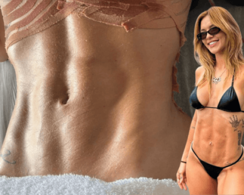 Virginia Fonseca exibe resultado de cirurgia após três gestações, veja agora!