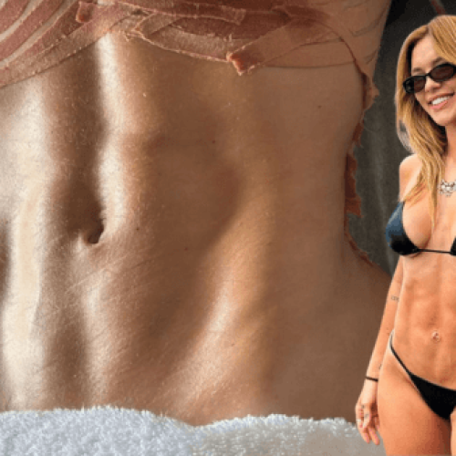 Virginia Fonseca exibe resultado de cirurgia após três gestações, veja agora!